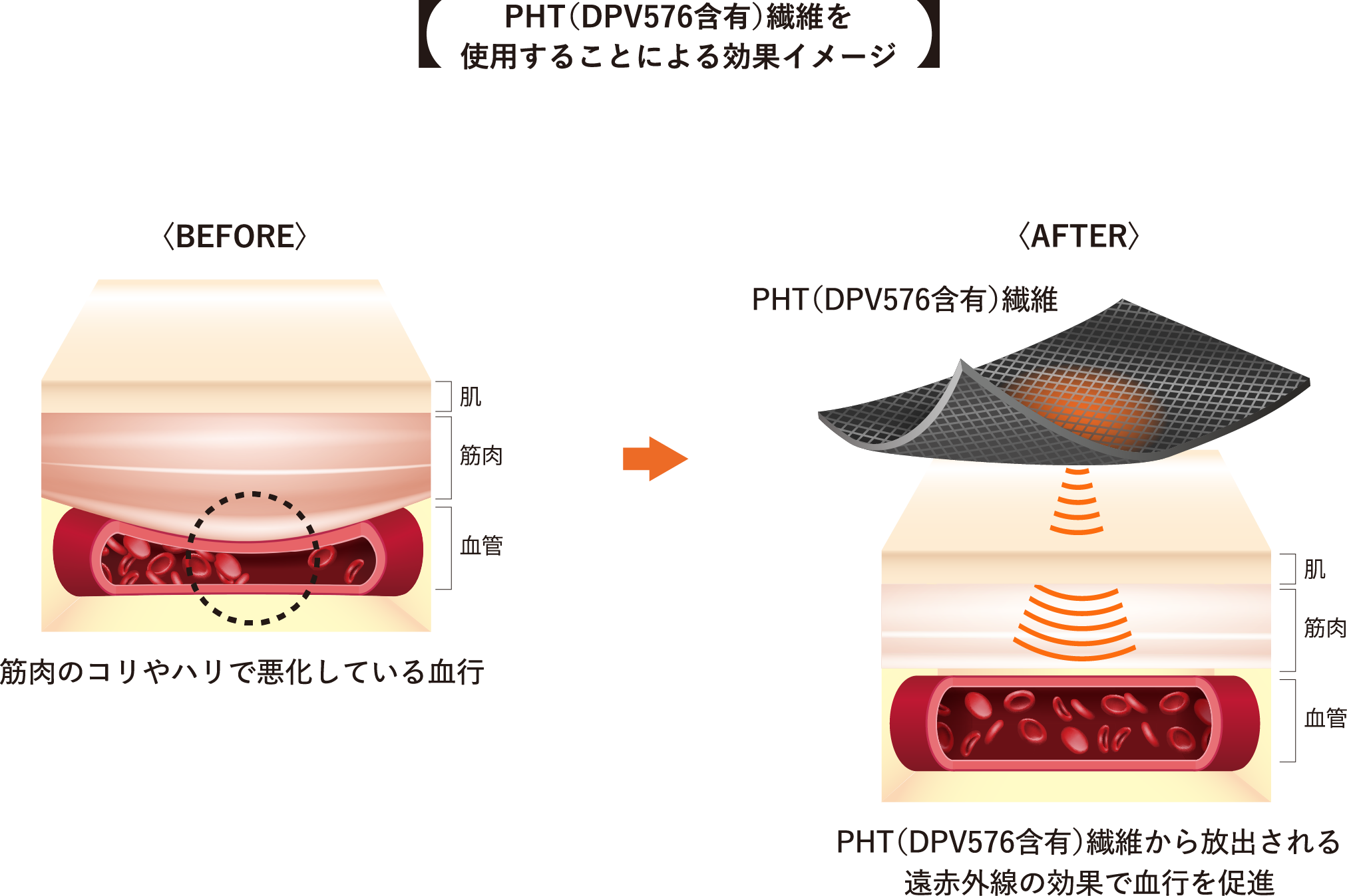 PHT（DPV576含有）遷移を使用することによる効果イメージ